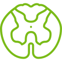 Lumbar Spondylosis treatment